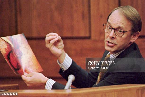 Dr. James T. Sehn holds a photo of the severed penis of John Wayne Bobbitt during the second day of the trial of Lorena Bobbitt in the Prince William...