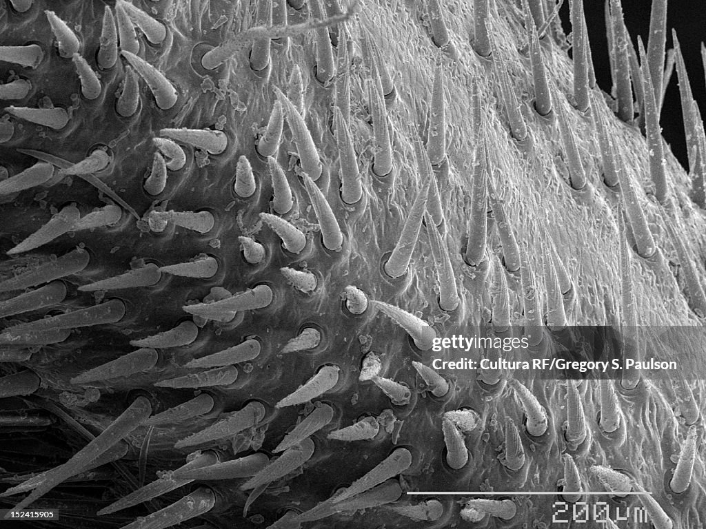 SEM Micrograph of spines on cicada leg