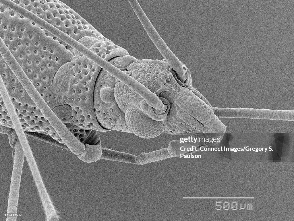 Sem Micrograph Of A Head Of A Bug High-Res Stock Photo - Getty Images