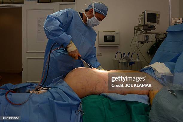 Plastic surgeon Dr.Askan Ghavami performs buttock enhancement cosmetic surgery on September 10, 2012 in Beverly Hills, California. Forget face lifts...