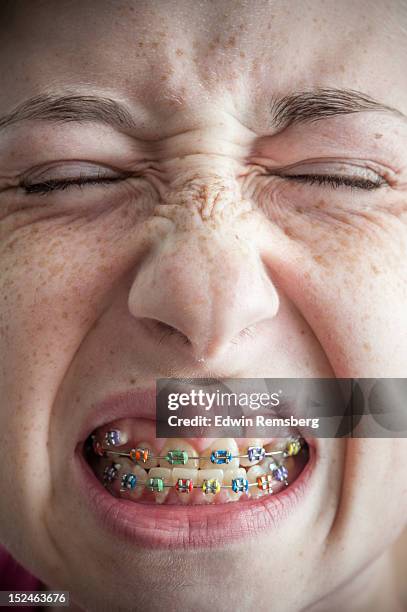 braces - grimacing stock pictures, royalty-free photos & images
