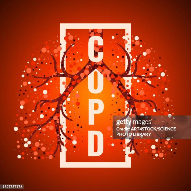 copd, conceptual illustration - calendar date stock illustrations