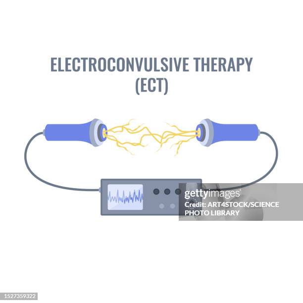 electroconvulsive therapy, illustration - mental illness infographic stock illustrations