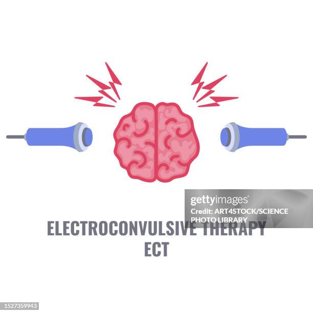 electroconvulsive therapy, illustration - bipolar disorder stock illustrations