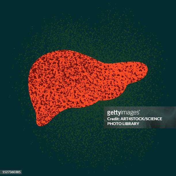 illustrazioni stock, clip art, cartoni animati e icone di tendenza di liver disease, conceptual illustration - cancrena