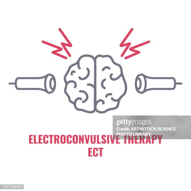 electroconvulsive therapy, illustration - mental illness infographic stock illustrations