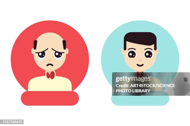 hyperthyroidism treatment, conceptual illustration - goiter stock illustrations
