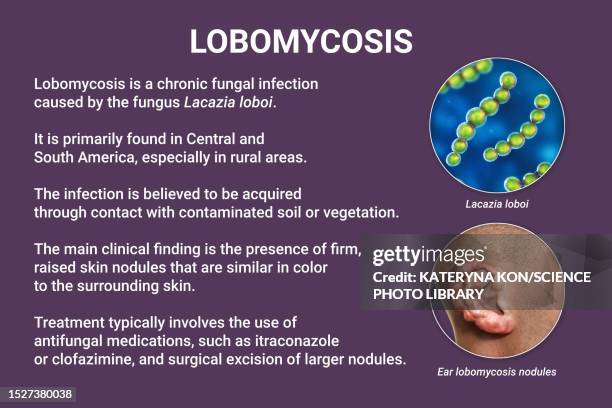 lobomycosis fungal infection, illustration - bud stock illustrations