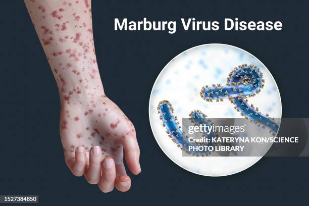 Skin Rash Arm Photos and Premium High Res Pictures - Getty Images