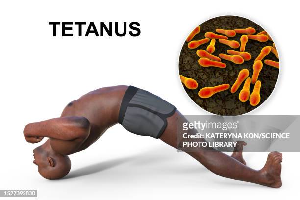 tetanus, illustration - clostridium tetani stock illustrations