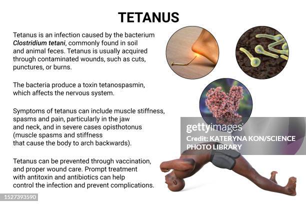 tetanus, illustration - clostridium tetani stock illustrations