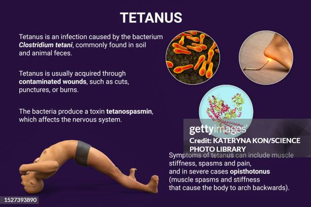 stockillustraties, clipart, cartoons en iconen met tetanus, illustration - clostridium tetani