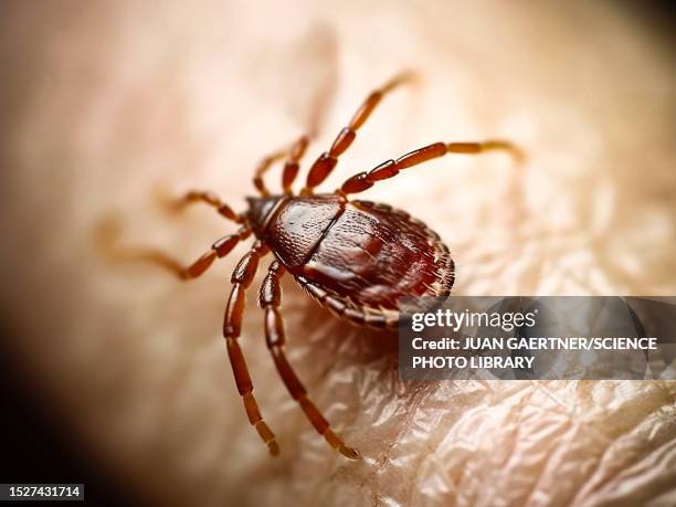 illustrazioni stock, clip art, cartoni animati e icone di tendenza di tick on human skin, illustration - acaro
