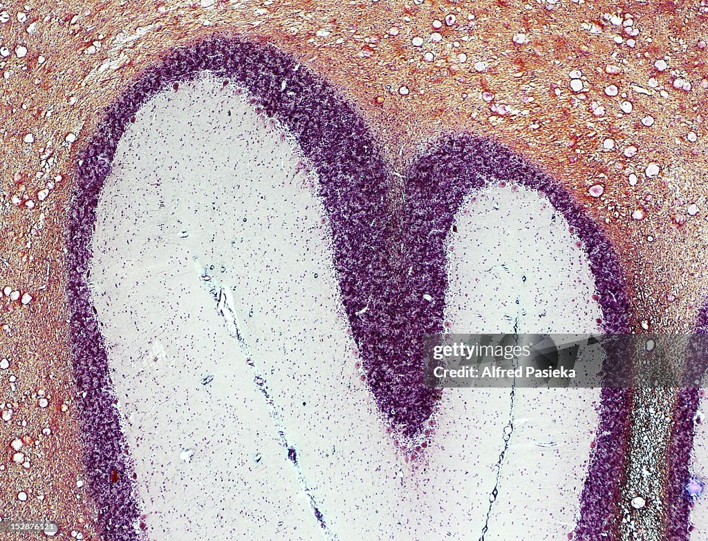 Cerebellum tissue micrograph
