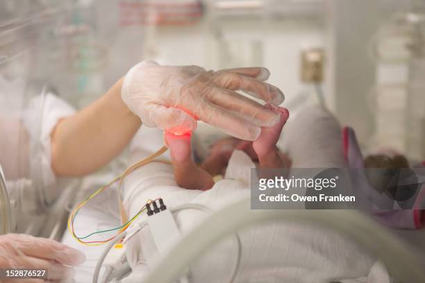 nurse with a newborn baby in an incubator - premature baby stock-fotos und bilder