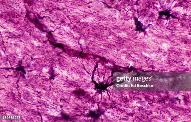 astrocyte in the brain touching a capillary,250x - astrocyte stockfoto's en -beelden