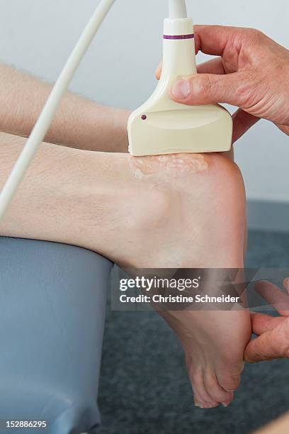 doctor using sonogram on patient - woman lying on stomach with feet up fotografías e imágenes de stock