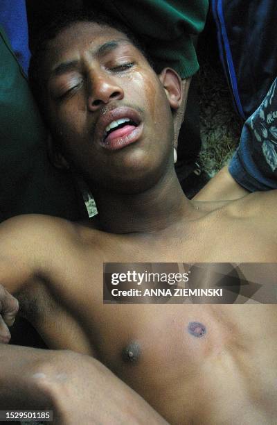 Youth from Tafelsig in Mitchell's Plain, Cape Town, weeps in pain from an injury after police fired rubber bullets at protesting residents 26...