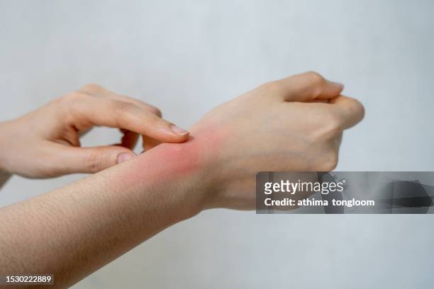 woman with wrist pain. - muscle cramps stock pictures, royalty-free photos & images