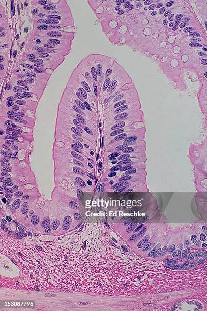 simple columnar epithelium, goblet cells & villus - 絨毛 ストックフォトと画像