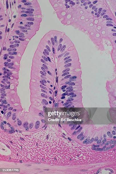 simple columnar epithelium, goblet cells & villus - simple columnar epithelial cell stock pictures, royalty-free photos & images