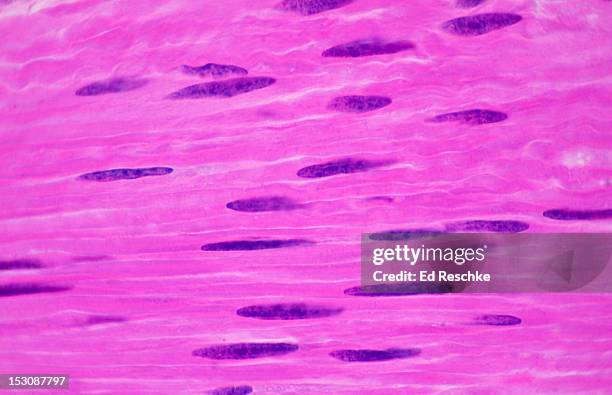 smooth muscle fibers (cells), small intestine,250x - muskelfaser stock-fotos und bilder