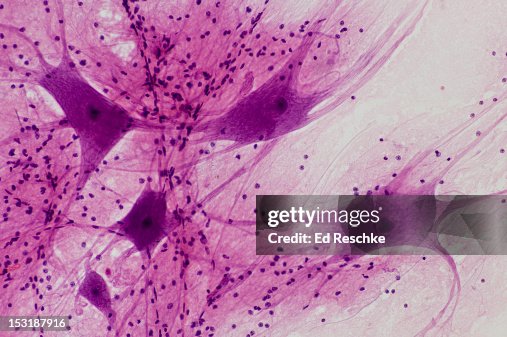 Neuron Endite Motor Neurons With Many Dendites 50x High-Res Stock Photo - Getty Images