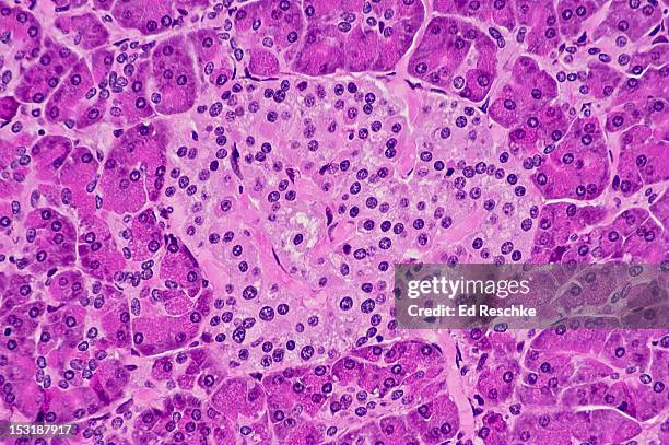 pancreatic islet (islet of langerhans), 100x - eilandjes van langerhans stockfoto's en -beelden