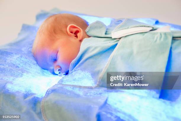 255 fotos e imágenes de Ictericia - Getty Images 255 fotos e imágenes de Ictericia - Getty Images