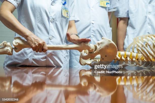 Medical staff discuss the treatment of femoral head necrosis at the First People's Hospital in Bijie, Southwest China's Guizhou province, July 13,...