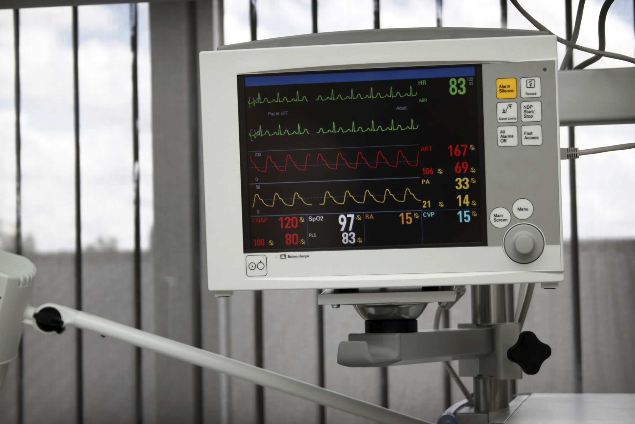 ekg machine