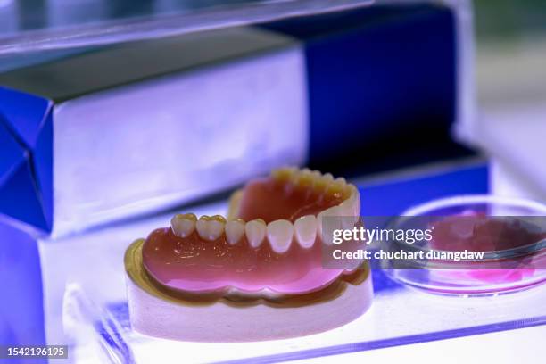 dental model of teeth - implante imagens e fotografias de stock