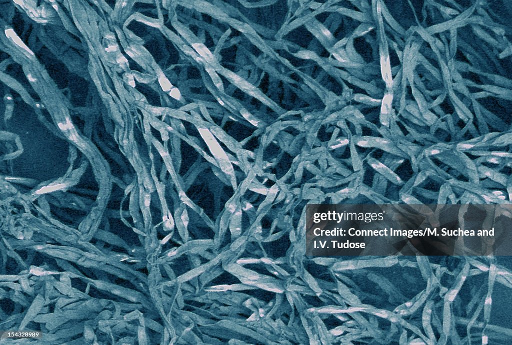 SEM Micrograph of fungi on grapes