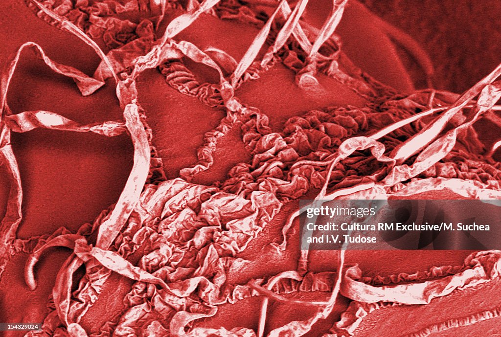 SEM Micrograph of fungi on grapes