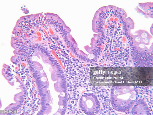 an image of celiac disease cells - celiac disease stock pictures, royalty-free photos & images