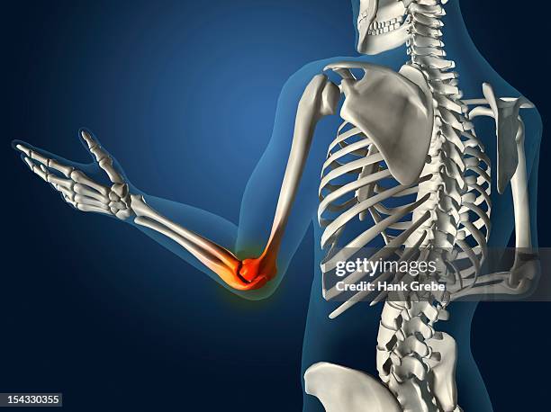 ilustraciones, imágenes clip art, dibujos animados e iconos de stock de x-ray view of elbow joint red with inflammation in a see-through arm with hand and spinal bones - radio hueso del brazo