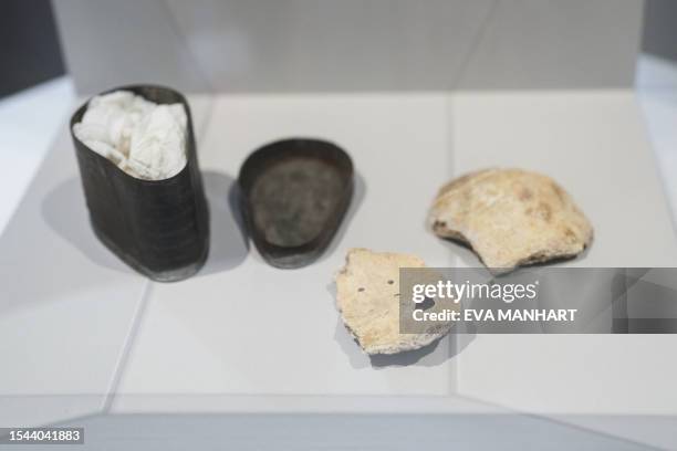 The skull fragments, presumed to be of Ludwig van Beethoven are on display at the Medical University of Vienna, Austria on July 20, 2023. Skull...