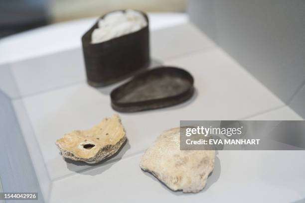 The skull fragments, presumed to be of Ludwig van Beethoven are on display at the Medical University of Vienna, Austria on July 20, 2023. Skull...