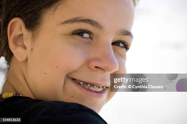 portrait of a girl (12) with teeth braces - cynthia classen ストックフォトと画像