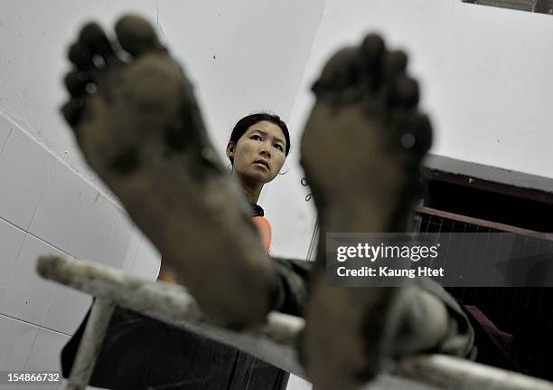 The blackened feet of a Buddhist Rakhine victim as his sister looks on in Kyauk Taw township hospital on October 25, 2012 in Kyauk Taw, Myanmar. Over...