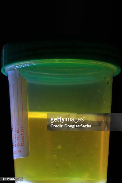 urine sample container for drug testing - urine cup stock pictures, royalty-free photos & images