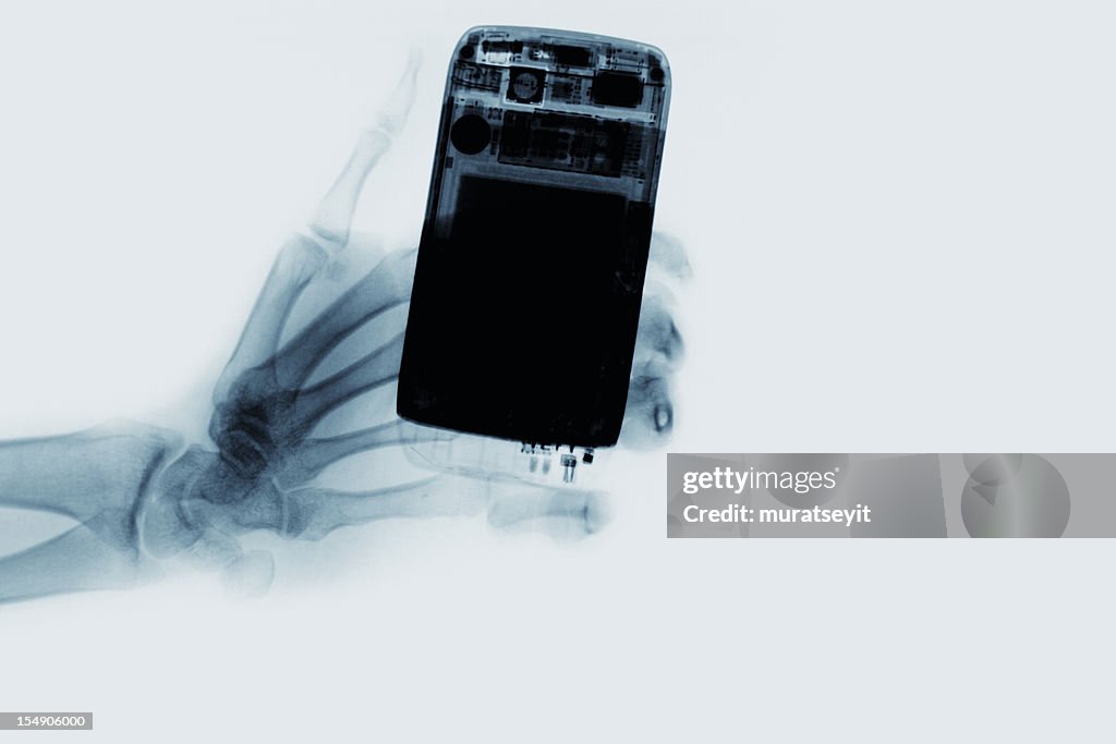 X-ray of a cell phone