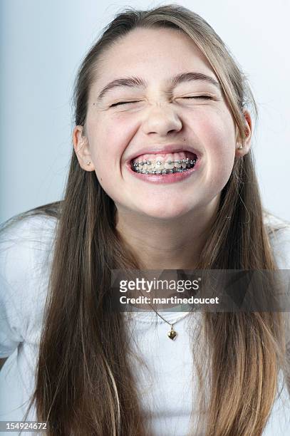 young girl making the biggest smile with braces, vertical. - teeth braces stock pictures, royalty-free photos & images