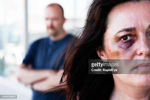 victim of domestic violence with threatening man in background - beaten up stock pictures, royalty-free photos & images