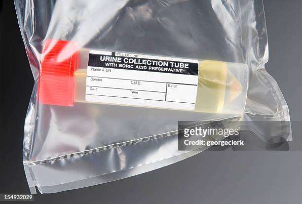 medical sample of urine - small plastic bag stock pictures, royalty-free photos & images