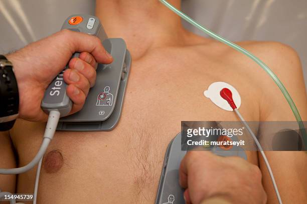 schockierende mann mit einem defibrillator - defibrillation stock-fotos und bilder