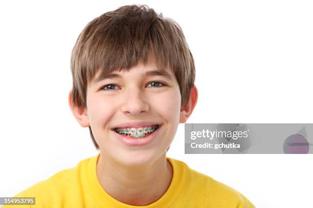 young boy with braces - boys with braces stock pictures, royalty-free photos & images