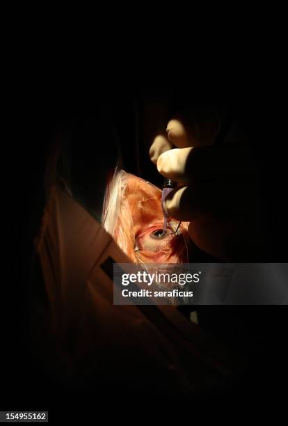 eye surgery: cataract - surgical glove stock pictures, royalty-free photos & images