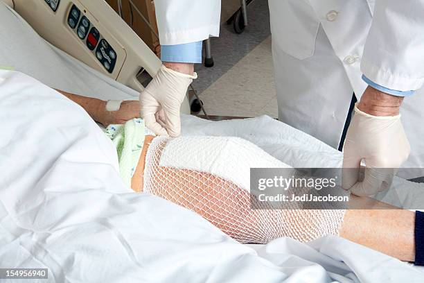 knee replacement bandage - old ugly woman stockfoto's en -beelden