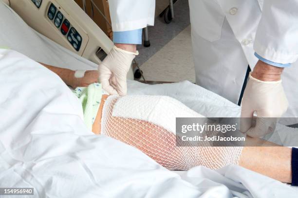 knee replacement bandage - healing wound stock pictures, royalty-free photos & images